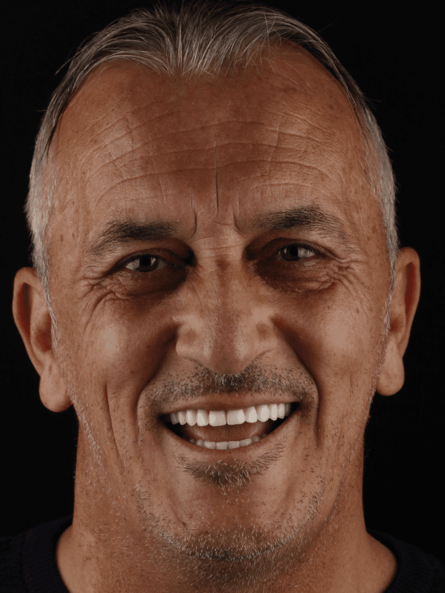 Posle tretmana