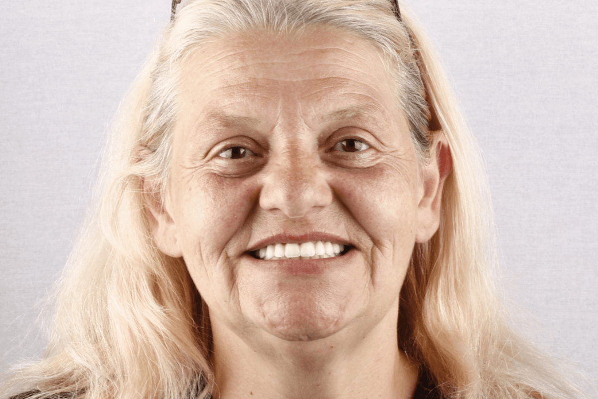 Posle — Mira, 67g.