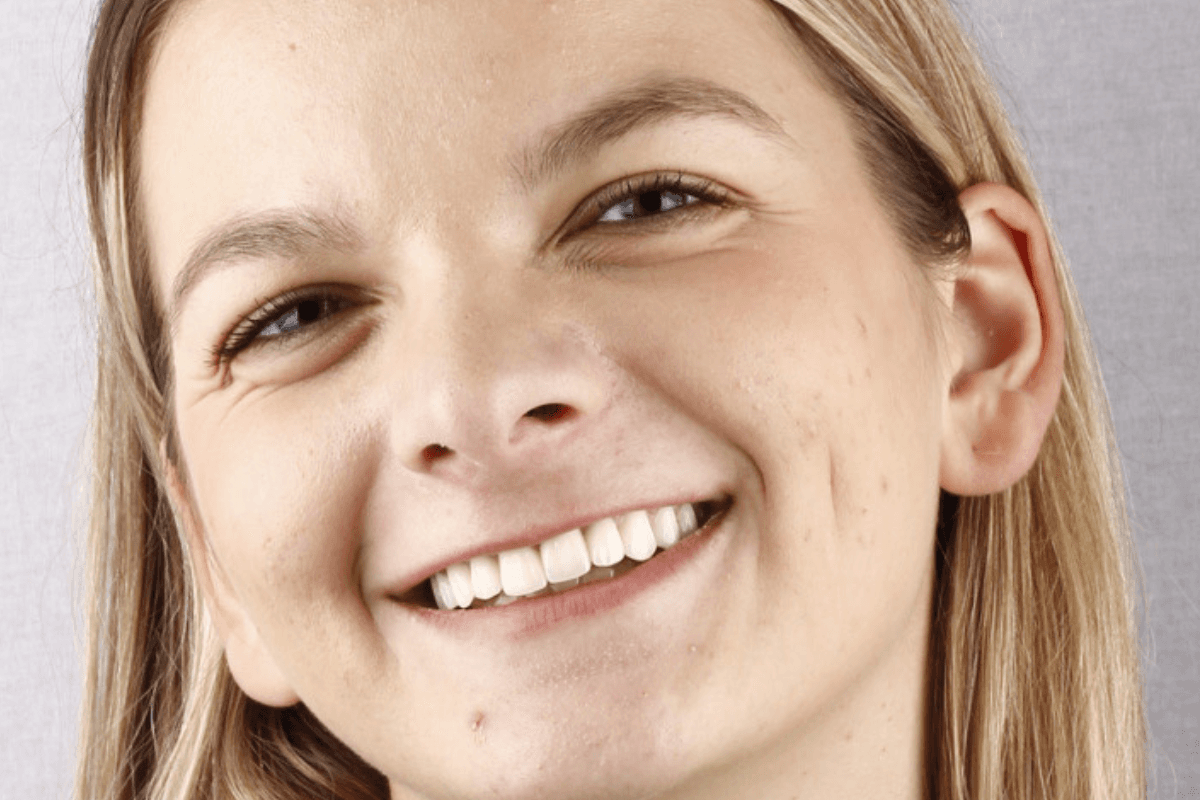 Posle — Tijana, 28g.