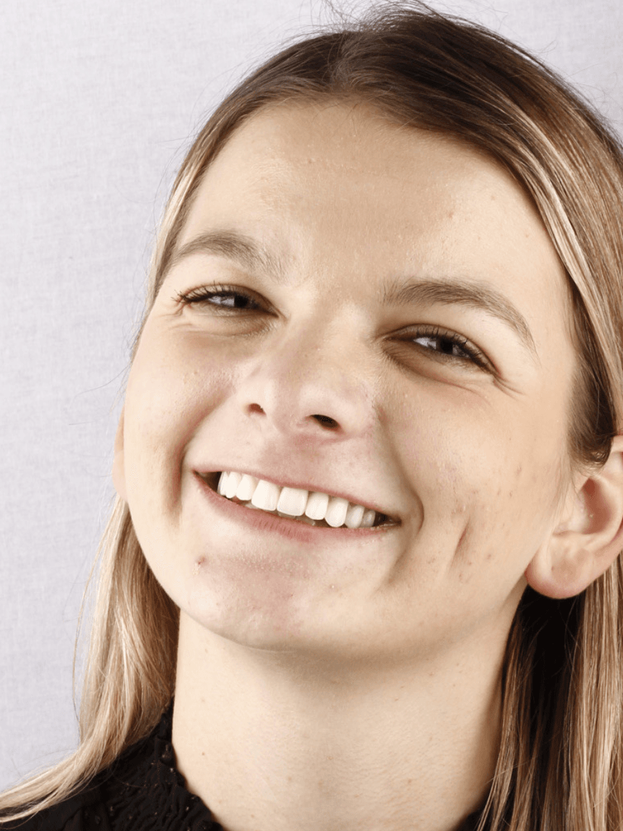 Posle — Tijana, 28g.