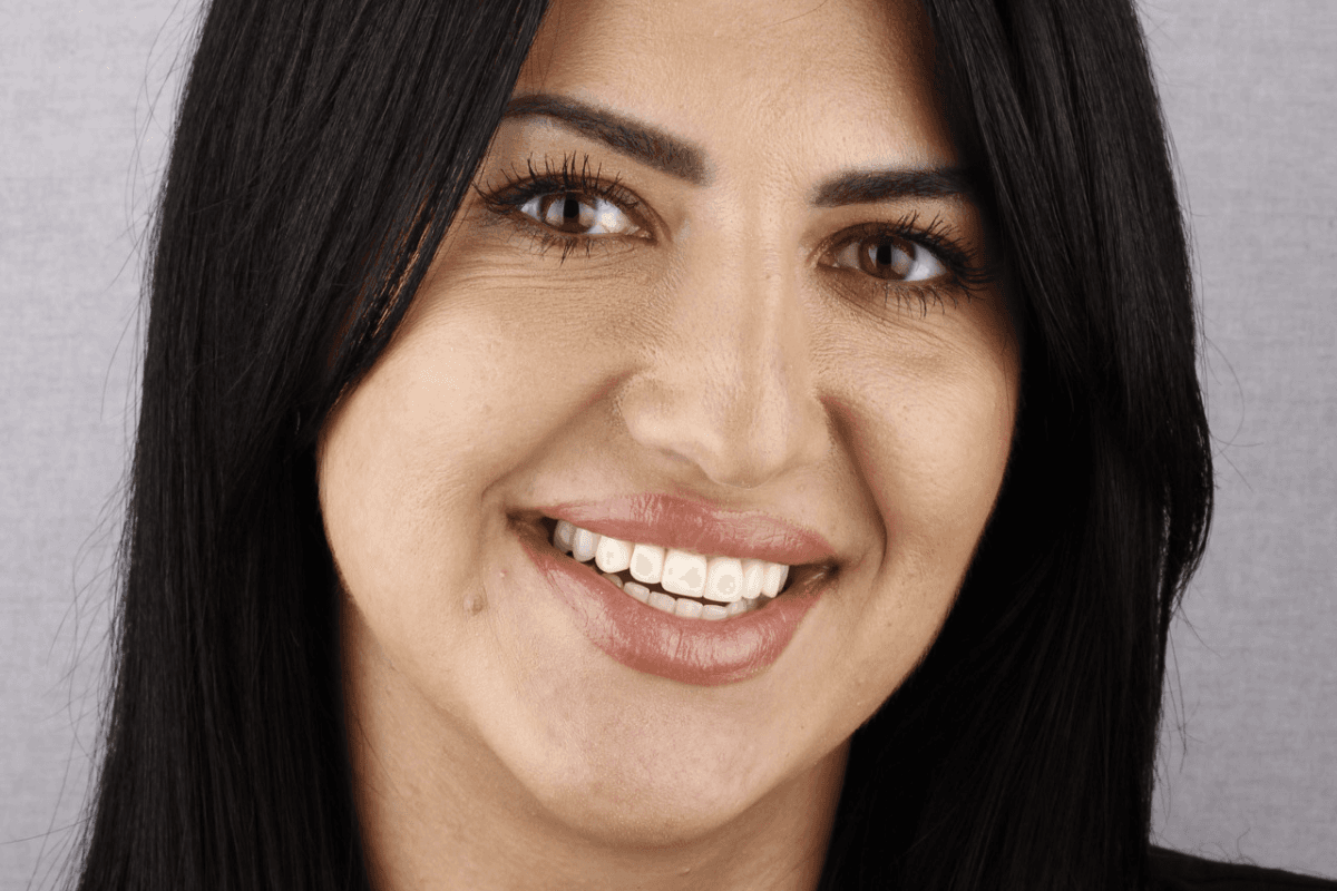 Posle — Ivana, 33g.