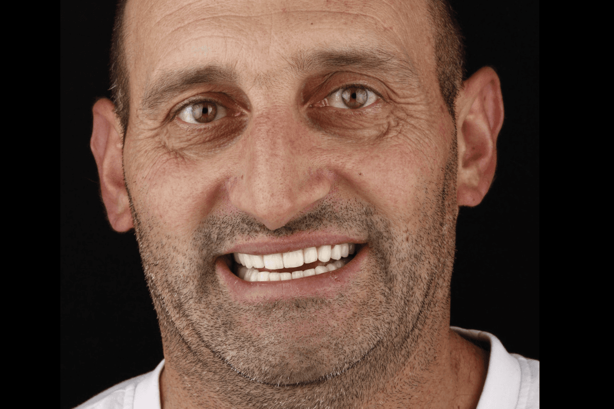 Posle — Marjan, 44g.