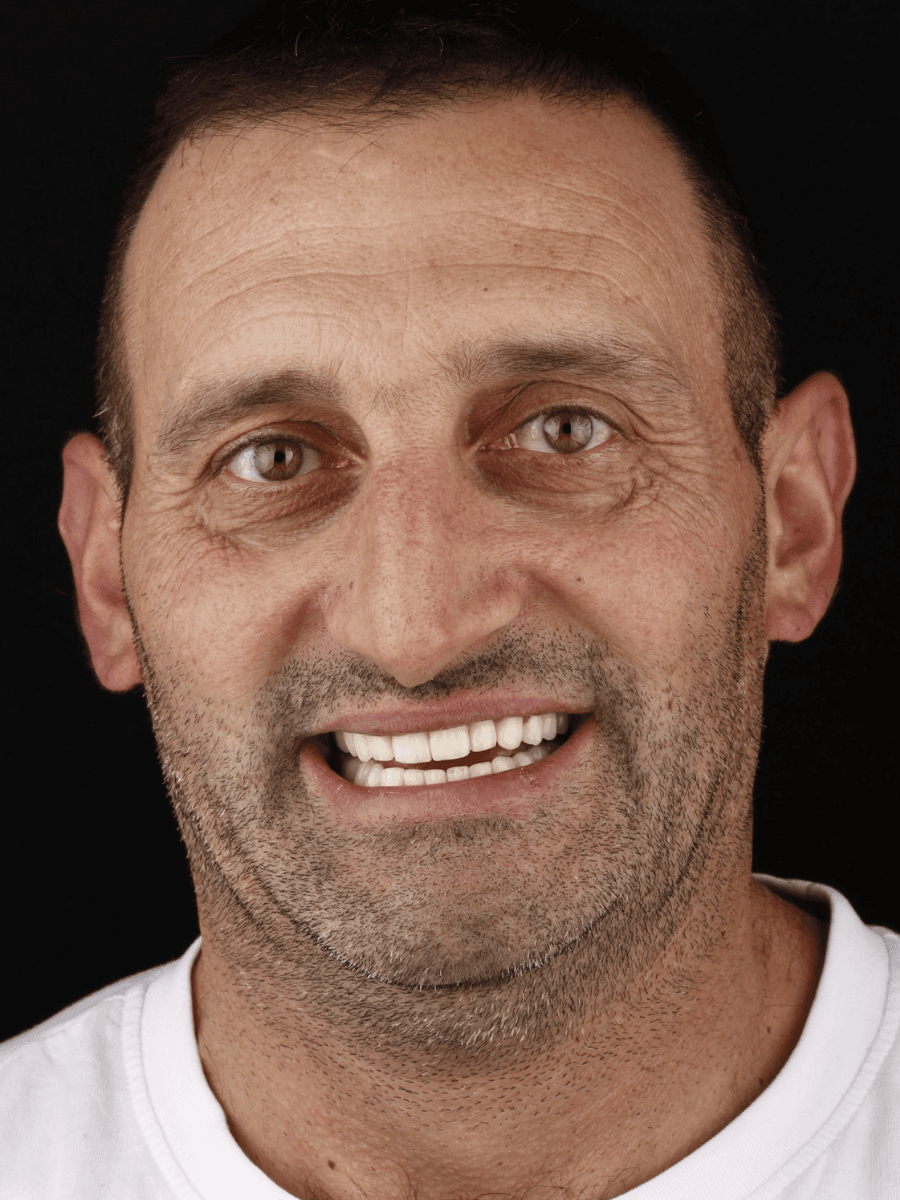 Posle — Marjan, 44g.