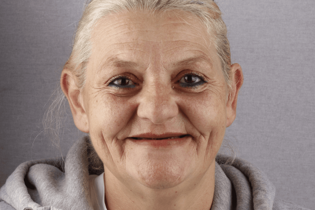 Pre — Mira, 67g.