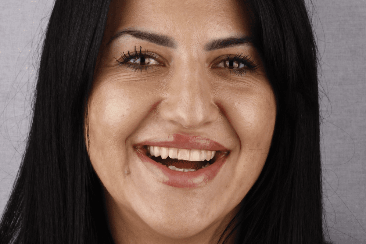 Pre — Ivana, 33g.