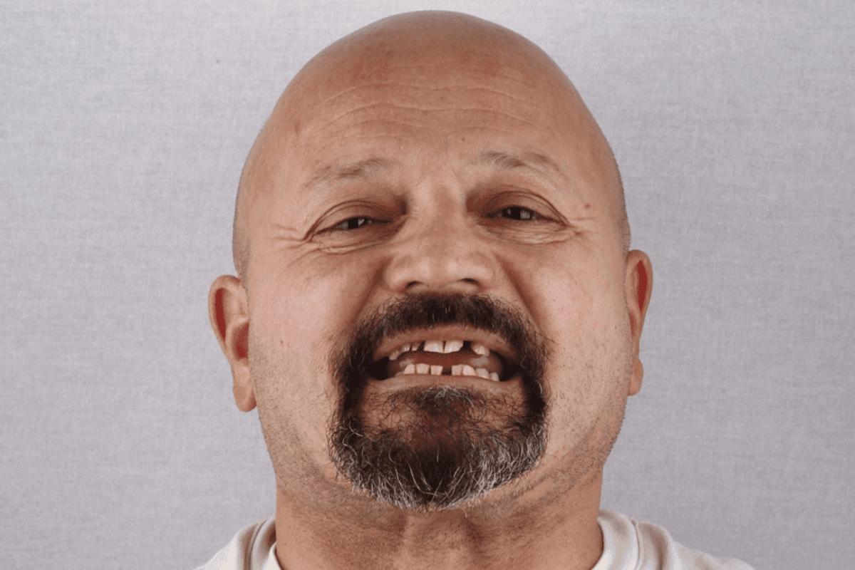 Pre — Siniša, 51g.